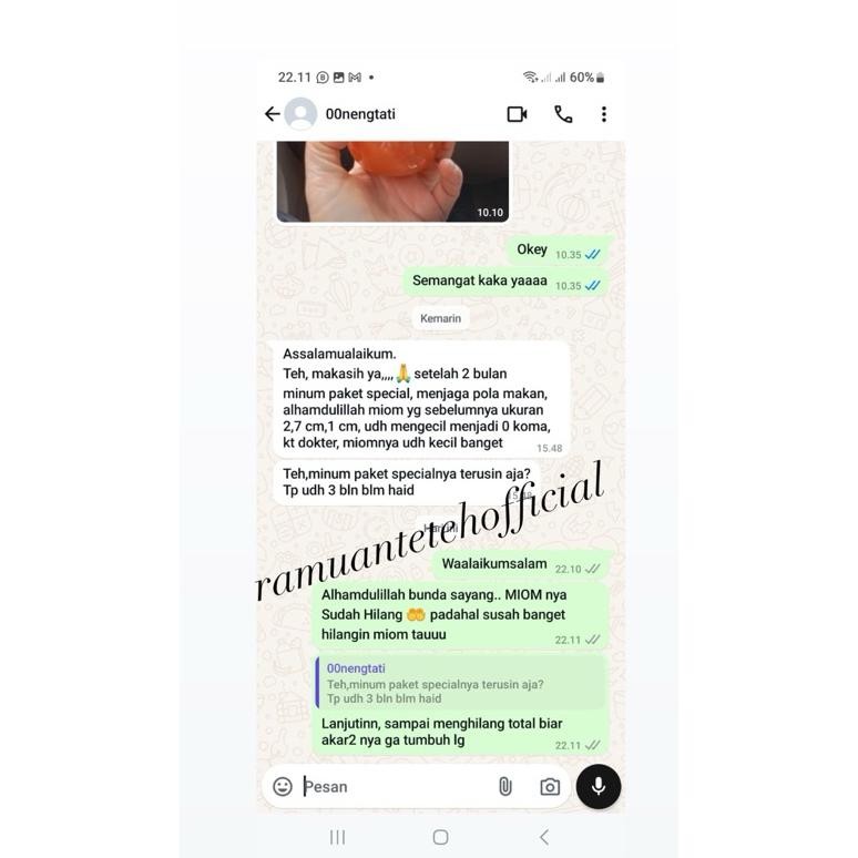 

Promo / Terlaris Kunyit Putih Murni Ramuan teteh Terbaik