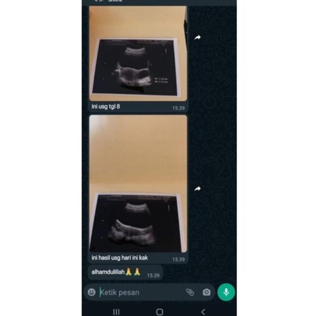 

Promo / Terlaris (PROMIL) Ramuan Kisah Nyata 450gr| Kesuburan | Program Hamil | Melancarkan Haid | Keputihan |Pria Wanita Terbaik