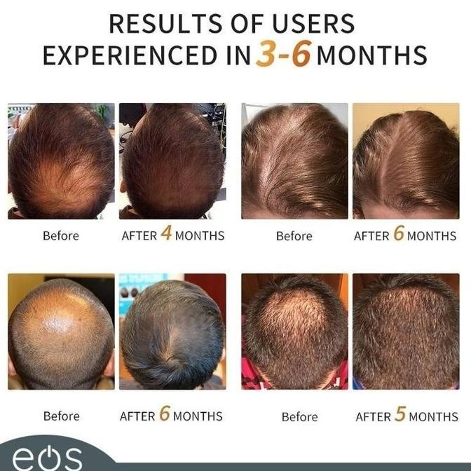 Terapi Perawatan Topi Rambut Kepala Infrared LED Merah murah