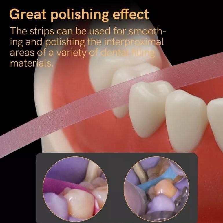 Dental Polishing Strip Gigi / Strip Poles Gigi RJ