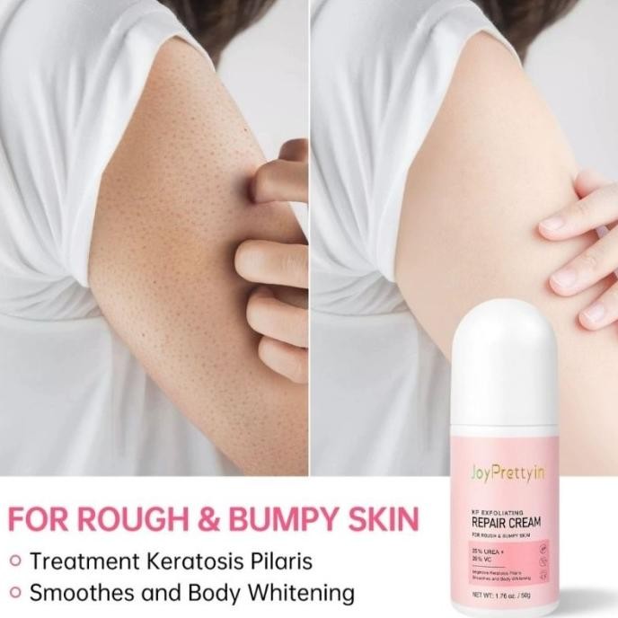 

READY READY! CHICKEN SKIN CREAM / KULIT AYAM PENGHALUS KULIT KASAR BINTIK HITAM KERATOSIS PILARIS