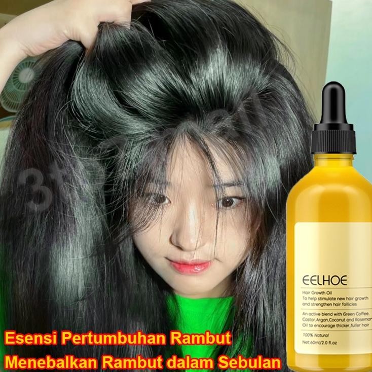 Romery Oil Untu Rambut Umbuh Rambut Erum Umbuh Rambut Hair Erum Rambut Ronto Hair Growth Vitan Umbuh