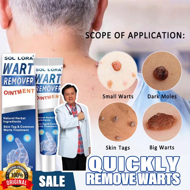 Wart Remover Cream / Wart Remover Pembersih Kutil / Skin Tag Remover 20G - Menghilangkan Kutil Tahi 