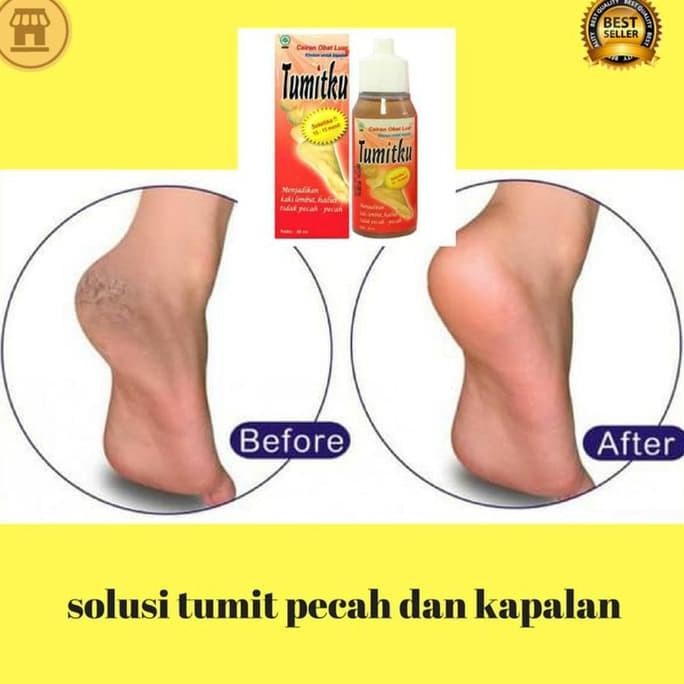 PJ TUMITKU Obat Kaki Pecah Dan Kering Foot Cream Penghalus Tumit Kaki Cream Kaki Pecah-pecah Ampuh
