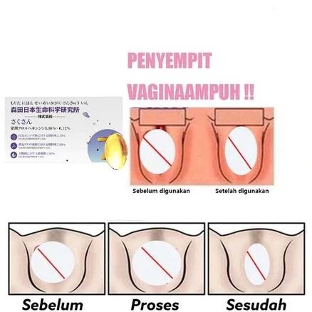 Perapat paling ampuh Rapet kembali perawan Perawatan Perapat 7 kapsul / kotak Perapat Permanen Agar 