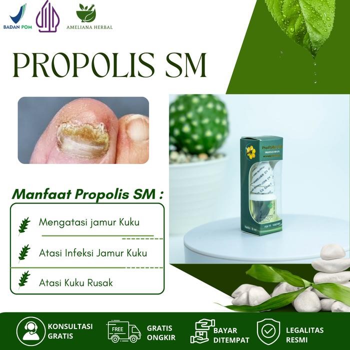 Penghilang Jamur Kuku, Infeksi Jamur Kuku, Atasi Kuku Rusak Dengan Propolis SM