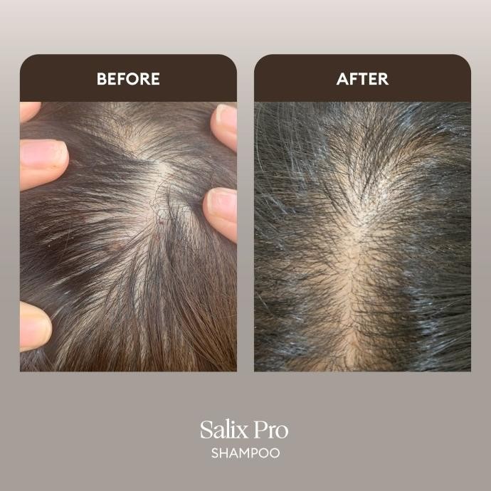 PROMO / THE BATH BOX - Salix Pro Haircare (Rambut Berketombe, Rambut Berminyak, Kulit Kepala Iritasi