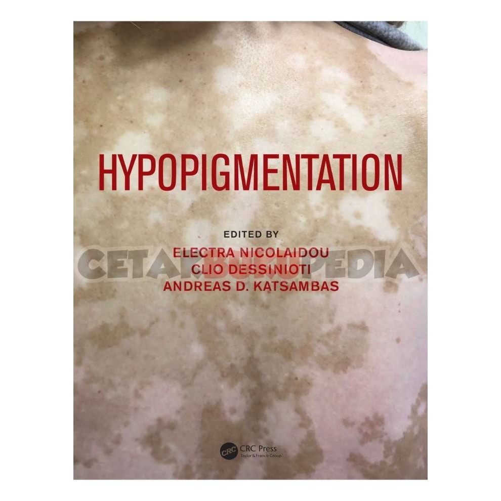 

Bookpo Hypopigmentation Softcover