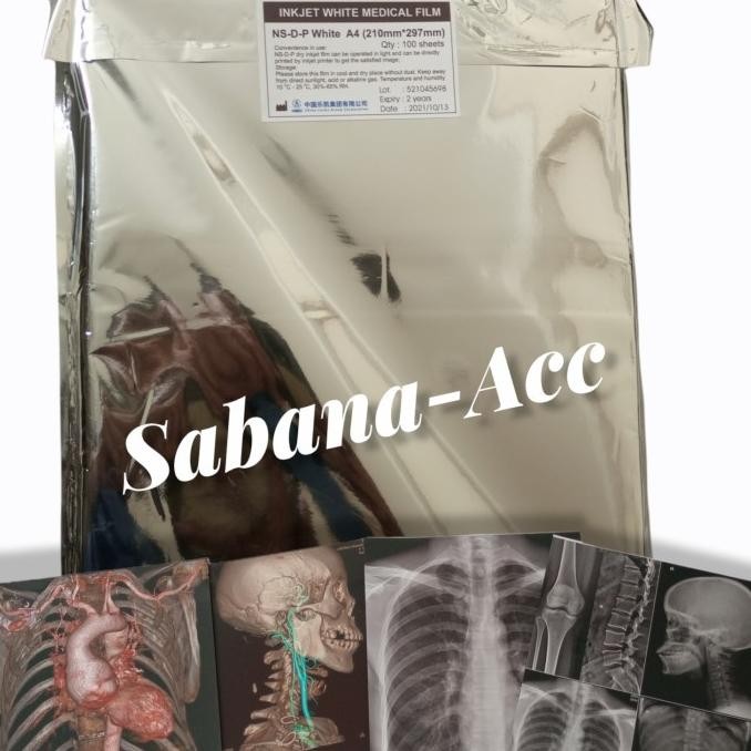 

inkjet white medical film radiologi a4 termurah