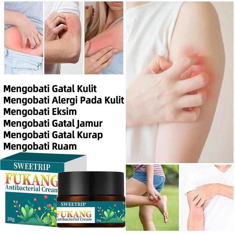 Salep Gatal Salep Khusus Psoriasis Obat Gatal Eksim Krim Psoriasis Paling Ampuh Kulit Kepala Psorias