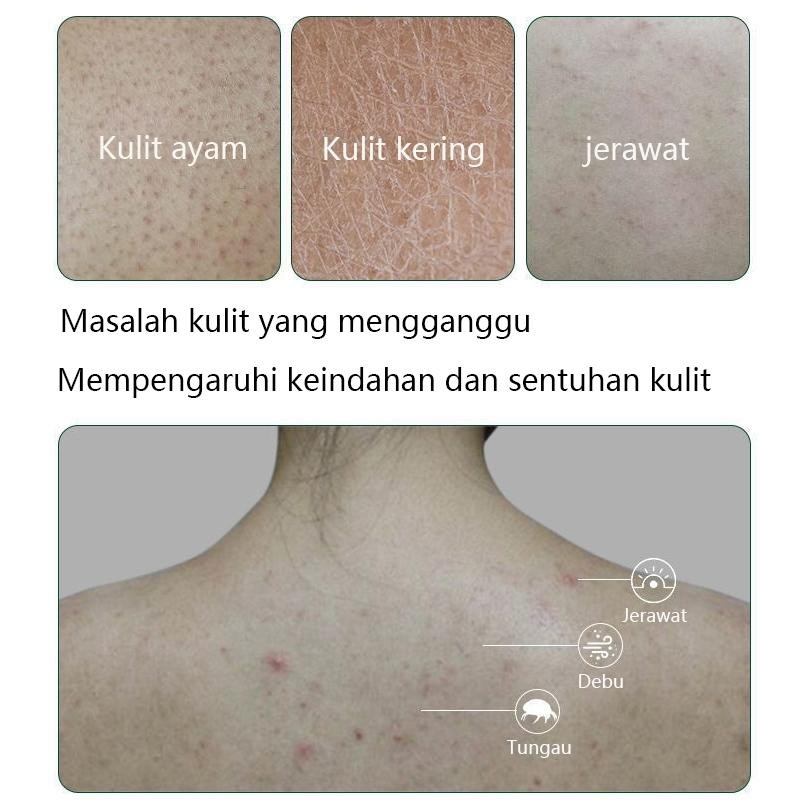 Eczema Body Wash 450Ml Pengobatan Eksim Psoriasis Eksim Kering Kurap Gatal Kulit Jamur Kulit Eksim L