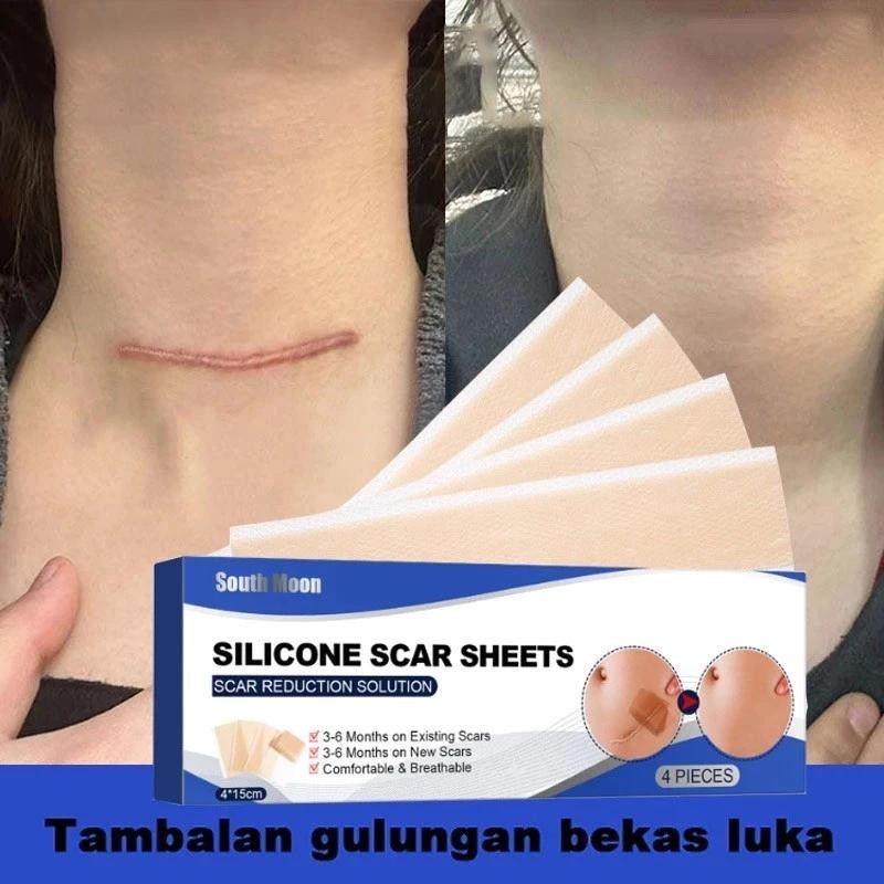 Silicone Scar Sheet Gel 4Pcs 4Cm X 7.5Cm Plester Silikon Penghilang Keloid Bekas Luka Plester Bekas 