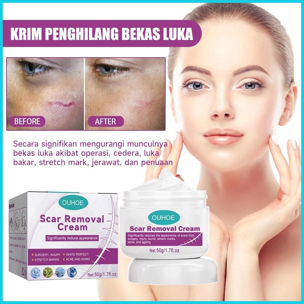 Sweetrip  Penghilang Bekas Luka Di Kaki Penghilang Bekas Luka Hitam Koreng Penghilang Bekas Cacar Ko