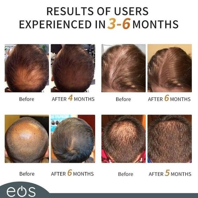 Murah Terapi Perawatan Topi Rambut Kepala Infrared Led Merah