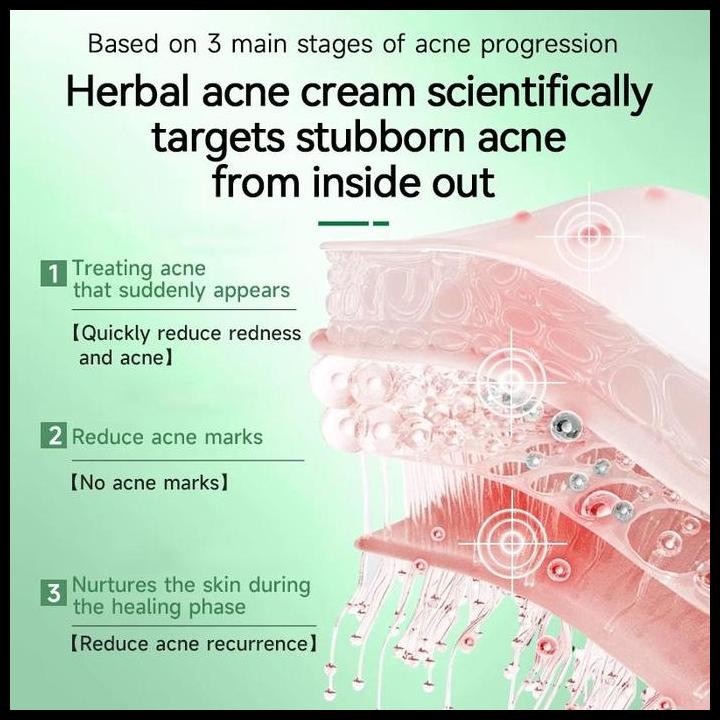 BpomCinsulin Salep Untuk Jerawat Totol Jerawat Ampuh Acnaway Omniskin Tretinoin Jf Sulfur Anti Acne 