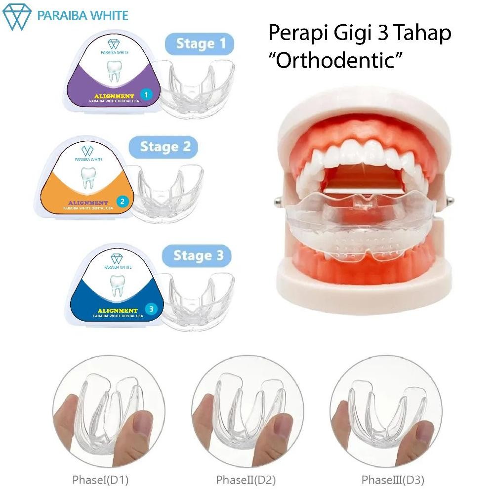 MARINA PERAPI GIGI - TEETH TRAINER ALLIGNMENT - ORTHODENTIC RETAINER - BEHEL KAWAT GIGI TRANSPARAN -