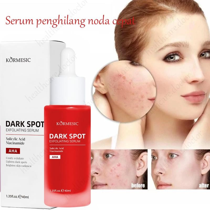 Serum Exfoliasi Wajah 40Ml Intensive Peeling Solution Serum  Exfoliasi Wajah Merah Exfoliating Serum