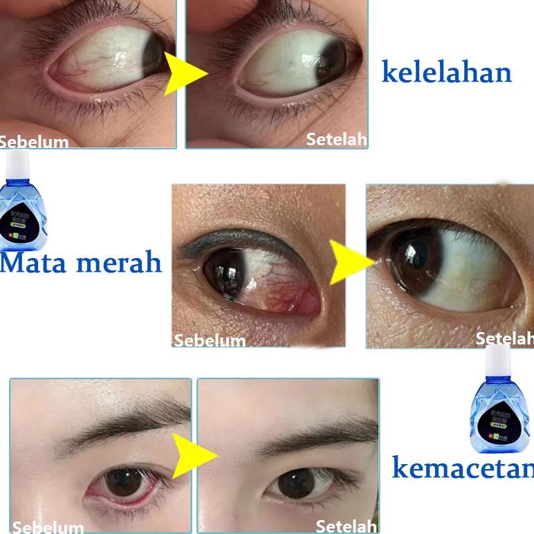 Ready Obat Tetes Mata Obat Mata Katarak Eye Drop Obat Mata Buram Obat Mata Berlemak Tetes Mata Herba