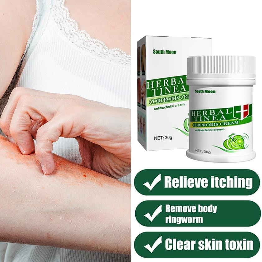 Premium Obat Salep gatal kutil cina Herbal Paling ampuh Salep alergi kulit gatal eksim jamur gatal H