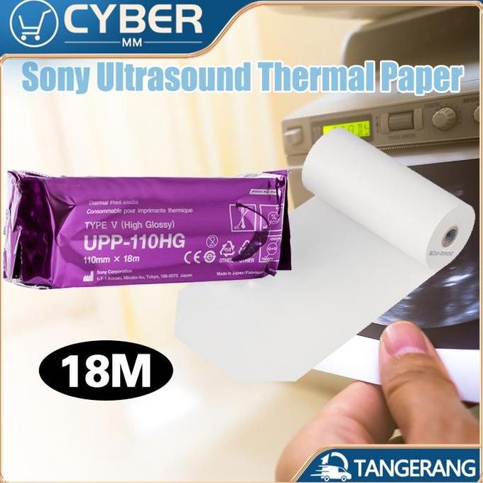 

TERBARU - Kertas Thermal Print USG Sony / Kertas USG Sony UPP 110HG Original