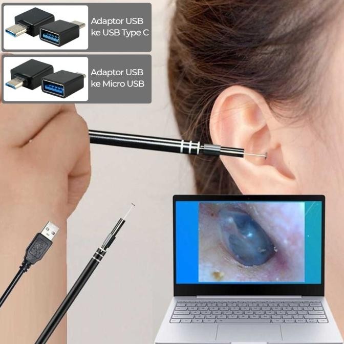 Produk Terbaik] kamera mini endoskop pembersih telinga anak USB-kamera korek kuping