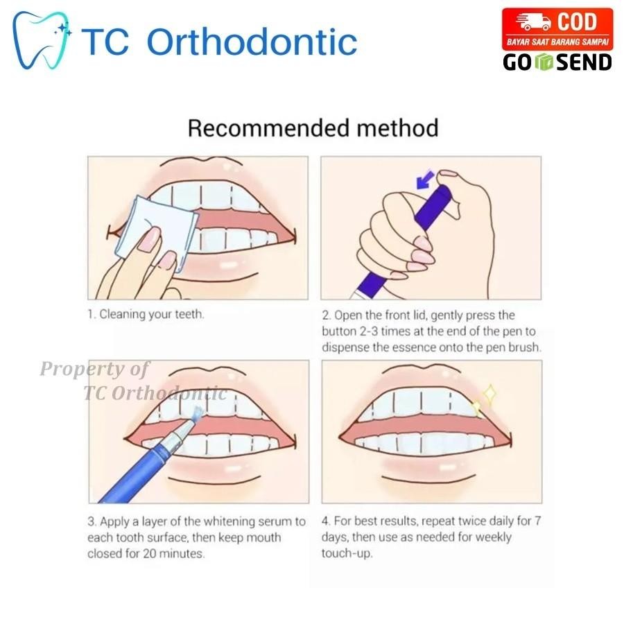 Pulpen Pemutih Gigi Dan Penghilang Karang Gigi/ Breylee Teeth Whitening Pen / Breylee Pen