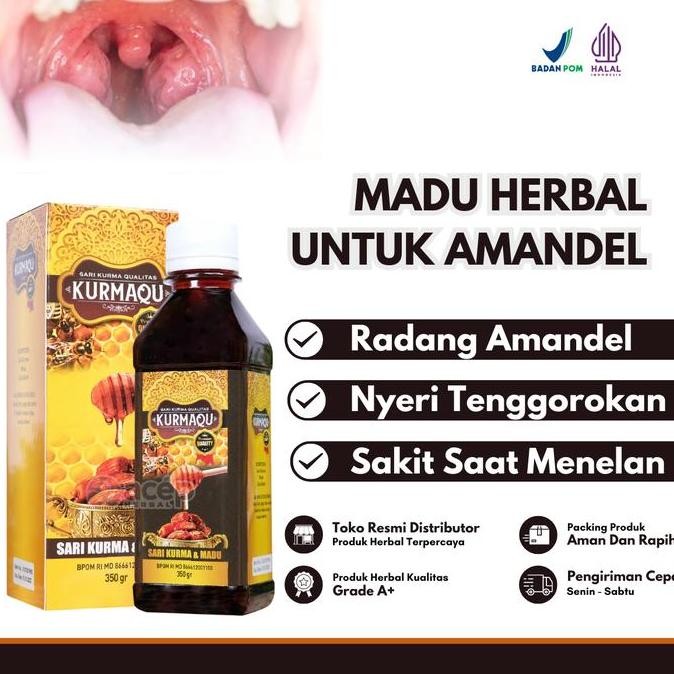 

BARU MADU HERBAL KURMAQU UNTUK AMANDEL ANAK DAN ISI 350 GRM