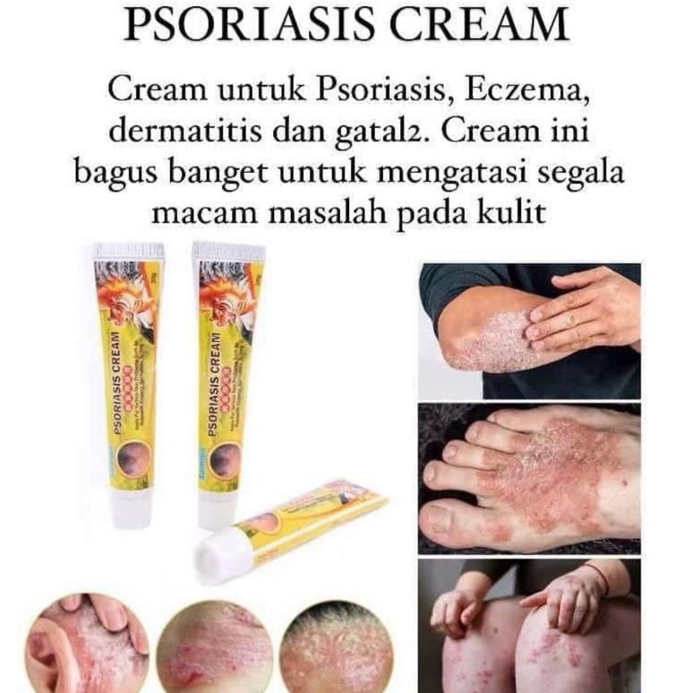PJ Psoriasis Cream