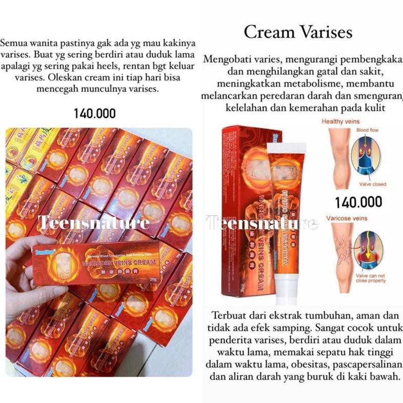 PJ Cream dan Koyo Varises Penang ginal