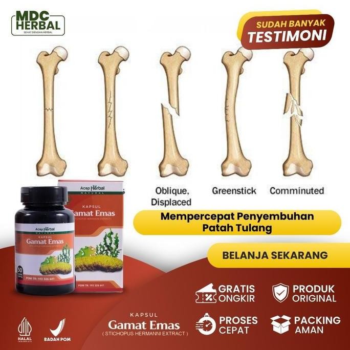 Mepercepat Penyembuhan Patah Tulang, Penyambung Tulang, Patah Tulang Untuk Tangan, Patah Tulang Kaki