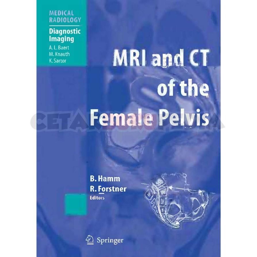 

Book Mri Ct Of Female Pelvis Softcover