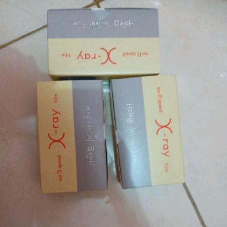 Baru X-Ray Film Hansin/X-Ray Film Hansin