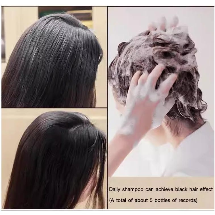 300Ml Natural Polygonum Shampoo Perawatan Rambut Anti Uban Penghilang Uban Permanen Di Usia Muda Pen