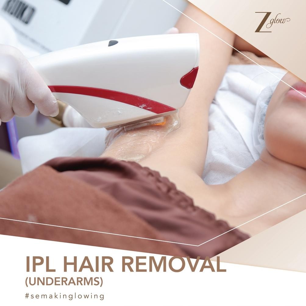 

MINDU ZGLOW HAIR REMOVAL UNDERARMS