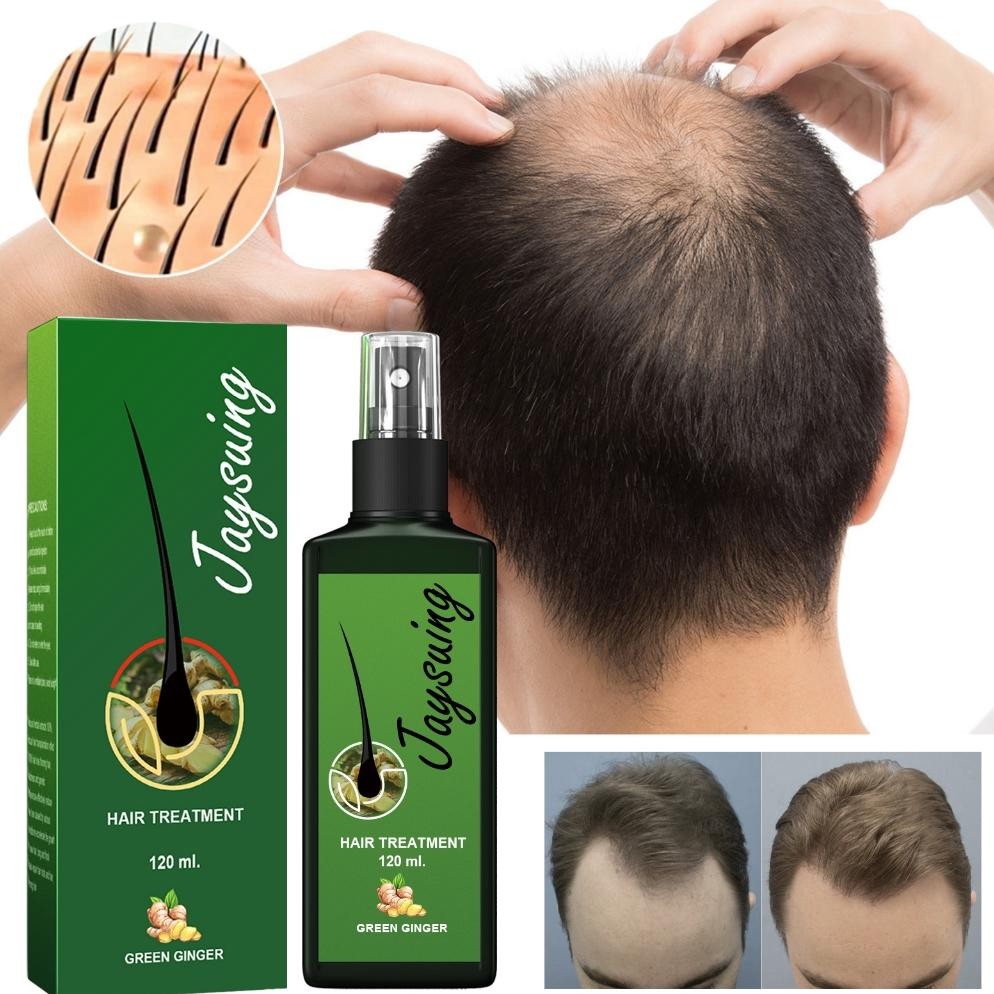 JAYSUING Rambut Serum Penumbuh Rambut 120ml Cepat Hair Growth Spray Penumbuh Rambut Penumbuh Rambut 