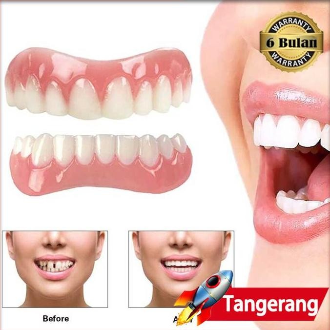 Gigi Palsu Instan Perfect Smile Veneer Gigi Tiruan Veneer Silikon