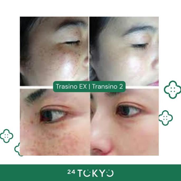 24Tokyo - [Ori Japan] Transino Ex - Transino White C Premium | Skin Brightening Support Flek Hitam J
