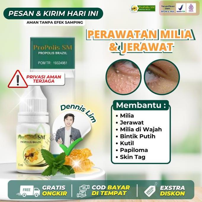 JAR_FASHIOM - PROPOLIS SM PENGHILANG MILIA, JERAWAT MILIA, MILIA DI WAJAH, MILIA DI SEKITAR MATA, BI
