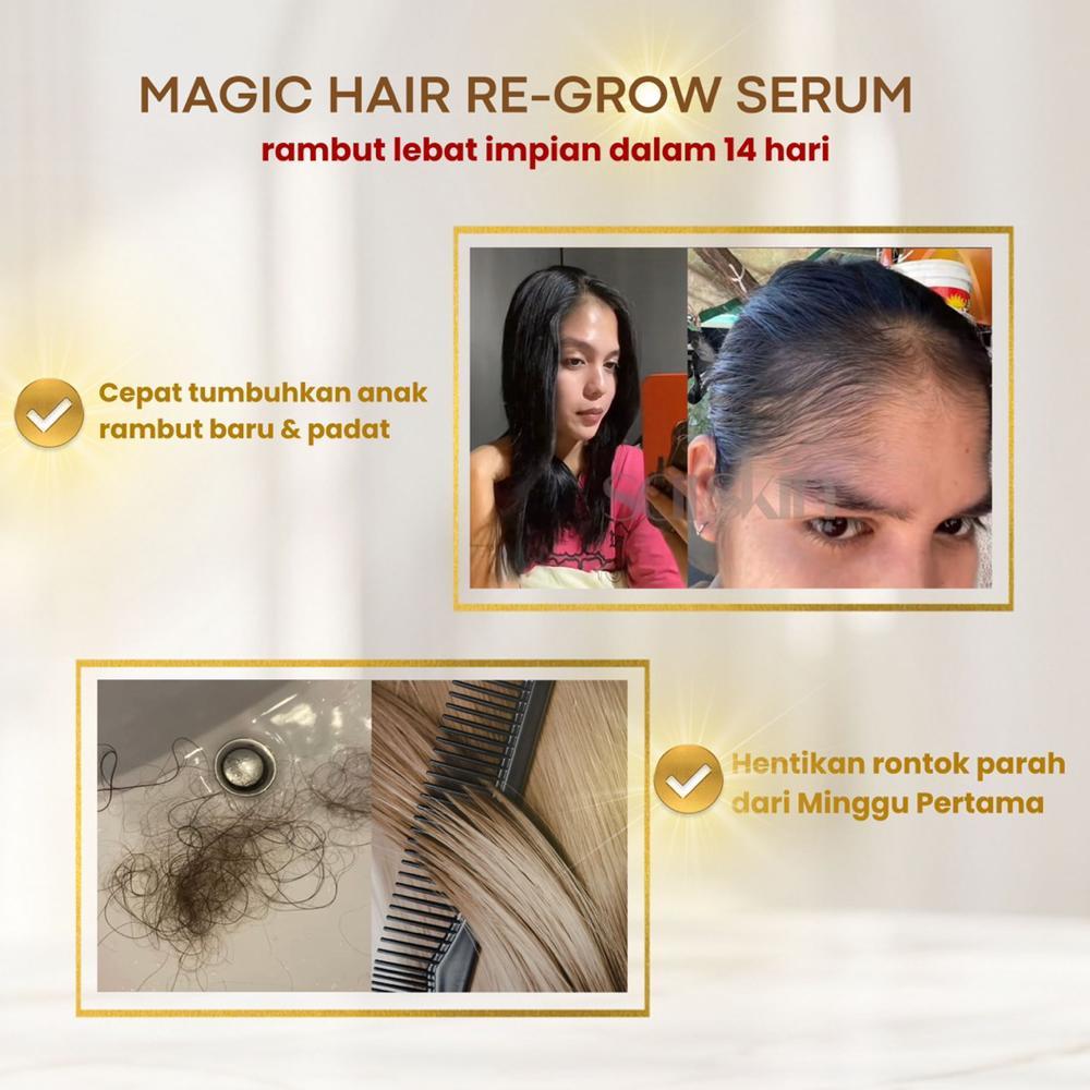 Serum Penumbuh Rambut SARSKIN HAIR SERUM (Paket Bundling) Perawatan rambut
