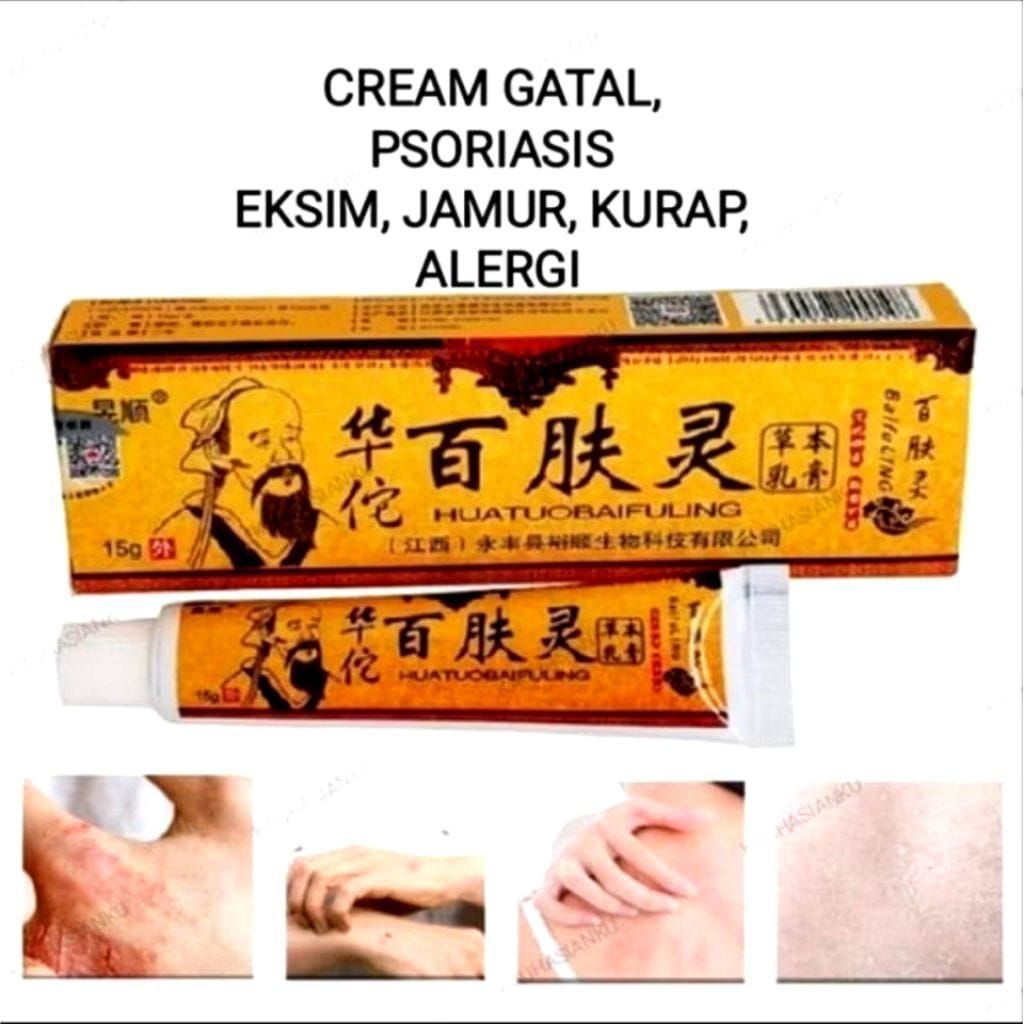 [PAKET 3PCS] SALEP CINA AMPUH ATASI GATAL ALERGI DAN PSORIASIS ORIGINAL100%