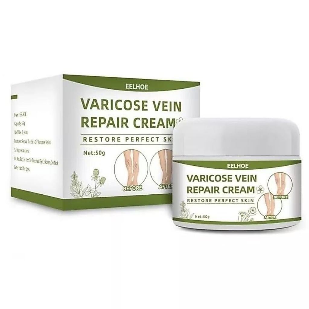 Obat Varises Salep Penghilang Varises Cream 50g,