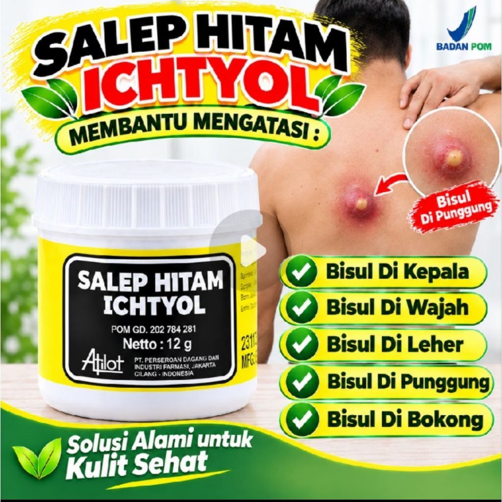Salep Bisul Benjol Ichtyol, Salep Bisul Udun, Salep Hitam Untuk Bisul, Obat Bisul Salep Hitam, Salep