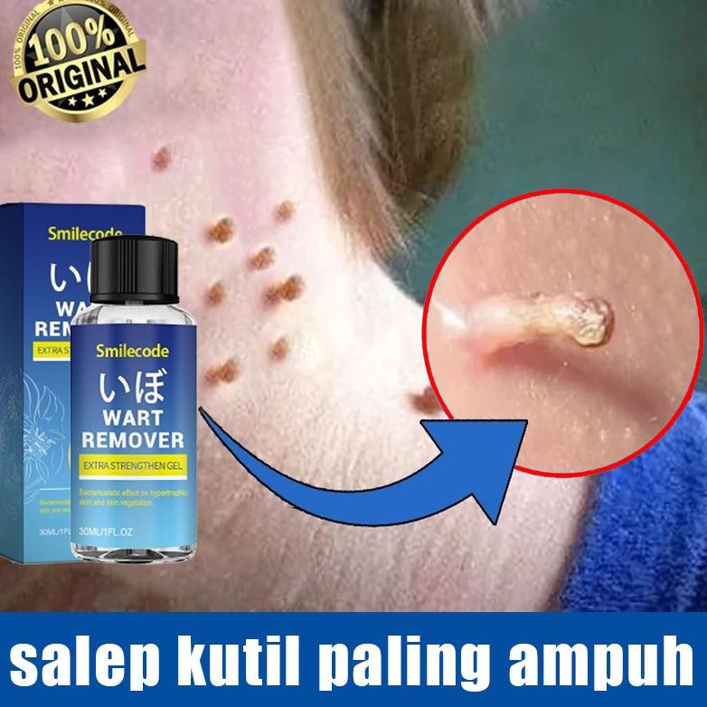 Bpom Wart Remover Original 30Ml Obat Kutil Paling Ampuh Oles Salep Penghilang Tahi Lalat Salep Kutil