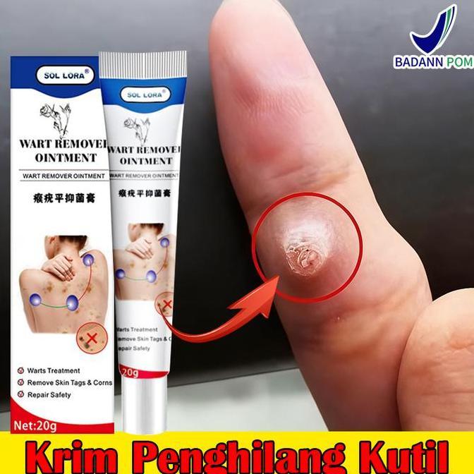 Facene- 0Bat Kutil Ampuh Penghilang Kutil Dan Tahi Lalat Di Jah P Kutil Paling Ampuh Obat Penghilang