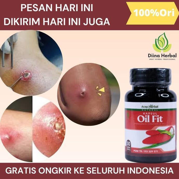 Hiha- Bisulan Dipantat, Bisul Bernanah, Bisul Gak Tumbuh Lagi, Bisul Di Kemaluan, Penghilang Bisul, 