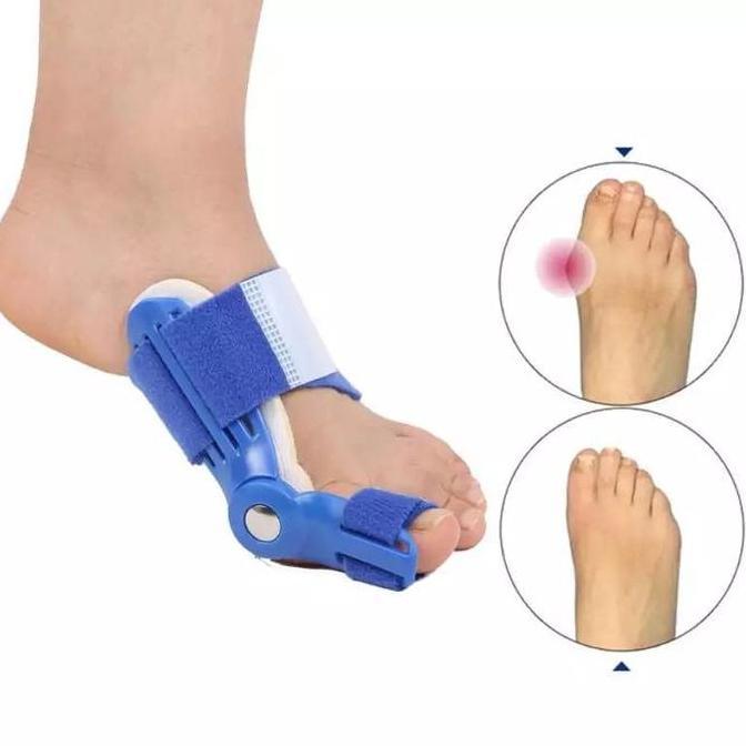 INSOLE KAKI BUNION DAN HALLUX VALGUS CORRECTOR KAKI BUNION INSOLE JARI KAKI BENGKOK TERAPI BUNION Sh