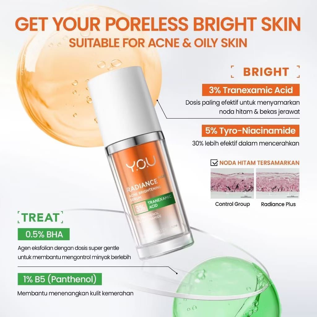 YOU Radiance Acne Brightening Serum