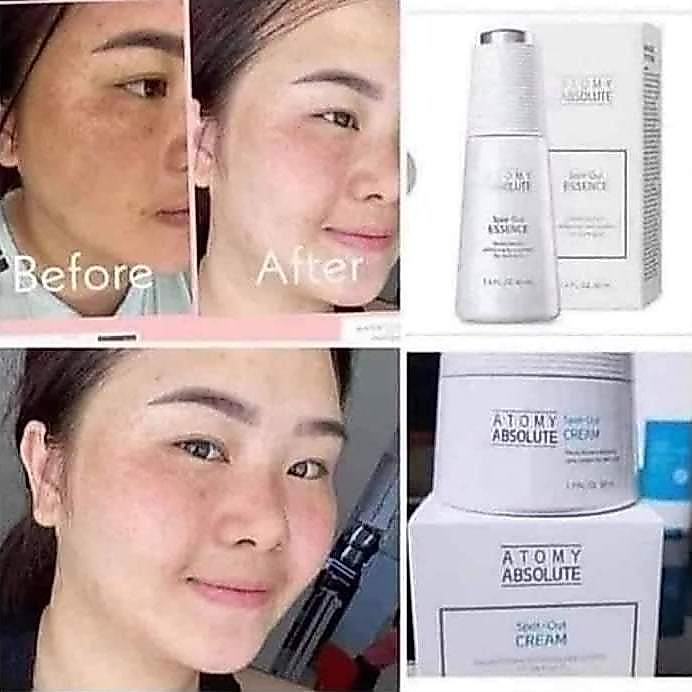 ATOMY 2IN1 ABSOLUTE SPOT OUT ESSENCE + CREAM KHUSUS WAJAH FLEK ORI READY