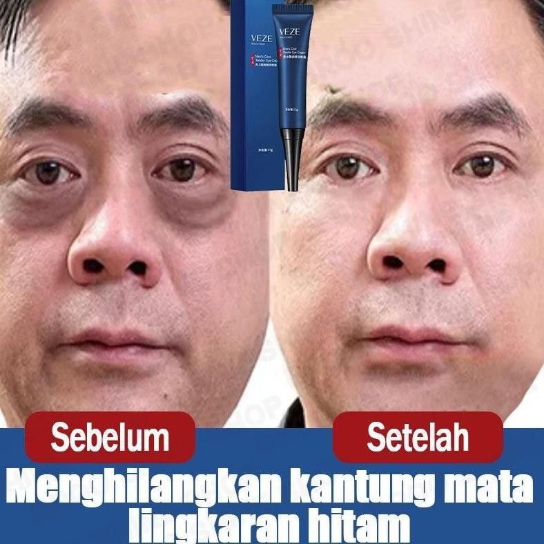 Kantung Mata Hilang Ampuh Cream Penghilang Kantung Mata Krim Mata Panda Dan Kantung Mata Cream Mata 