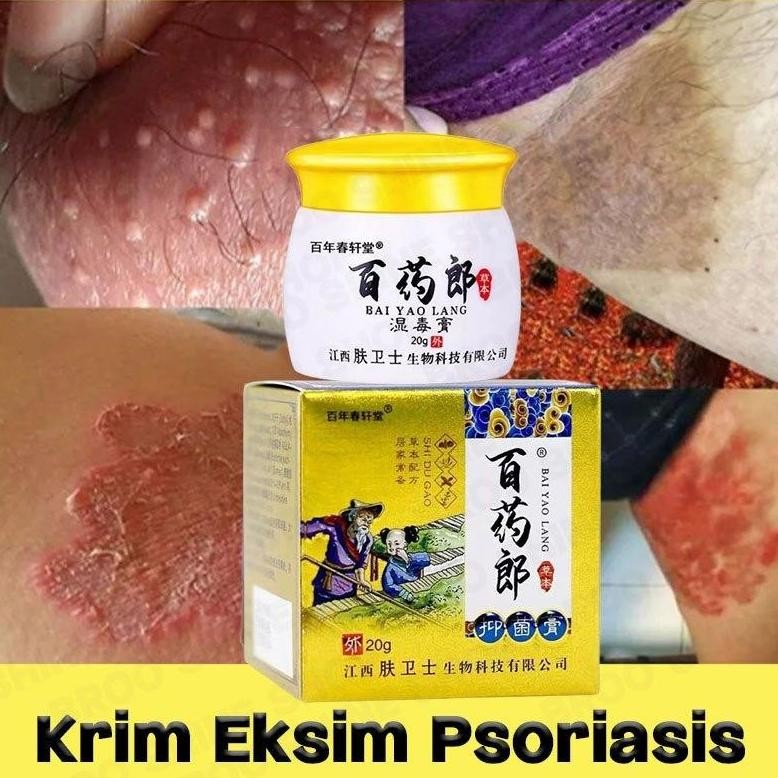 Salep Exim Gatal Eksim Paling Ampuh Salap Kurap 0Bat Gatal Di Selangkangan Badan Meredakan Miss V Ga